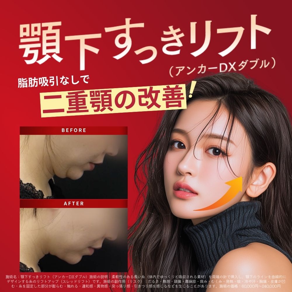 【切らずに二重アゴ改善！】話題の治療が新潟で。湘南美容が顎下専用に開発した新しい糸リフトを徹底解説！